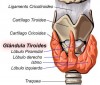 Causas del hipotiroidismo subclínico